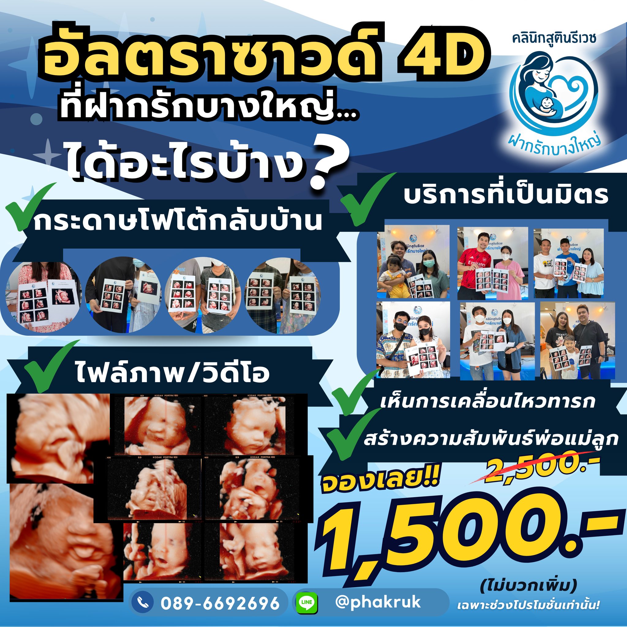 อัลตราซาวด์ 4D